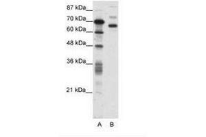 Image no. 1 for anti-CCCTC-Binding Factor (Zinc Finger Protein)-Like (CTCFL) (AA 211-260) antibody (ABIN6736093) (CTCFL antibody  (AA 211-260))