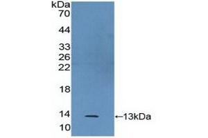 Detection of Recombinant S100A2, Human using Polyclonal Antibody to S100 Calcium Binding Protein A2 (S100A2) (S100A2 antibody  (AA 2-98))