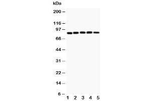Western blot testing of IKK alpha antibody and Lane 1:  MCF-7 (IKK alpha antibody  (AA 411-745))