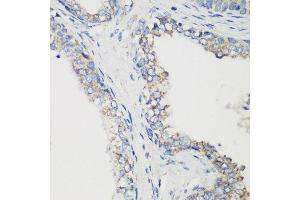 Immunohistochemistry of paraffin-embedded human prostate using GLUD1 antibody at dilution of 1:200 (40x lens). (GLUD1 antibody)