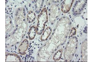 Image no. 1 for anti-Cancer/testis Antigen 1B (CTAG1B) antibody (ABIN1499893) (CTAG1B antibody)