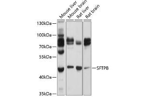 Western blot analysis of extracts of various cell lines, using SFTPB Antibody (ABIN6147687) at 1:1000 dilution. (SFTPB antibody  (AA 94-393))
