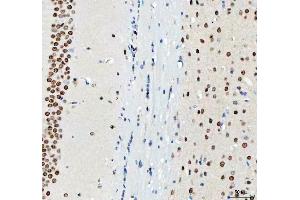 IHC analysis of DDX1 using anti-DDX1 antibody (ABIN7602052). (DDX1 antibody  (AA 562-740))