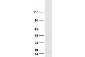 Western Blotting (WB) image for Synovial Sarcoma Translocation Gene On Chromosome 18-Like 2 (SS18L2) protein (Myc-DYKDDDDK Tag) (ABIN2732689)