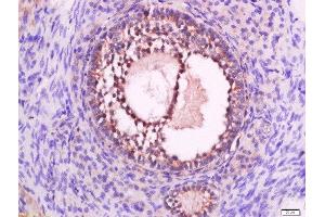 Paraformaldehyde-fixed, paraffin embedded rat ovary tissue, Antigen retrieval by boiling in sodium citrate buffer(pH6) for 15min, Block endogenous peroxidase by 3% hydrogen peroxide for 30 minutes, Blocking buffer (normal goat serum) at 37°C for 20min, Antibody incubation with Rabbit Anti-P2Y9 Polyclonal Antibody, Unconjugated  at 1:500 overnight at 4°C, followed by a conjugated secondary and DAB staining (LPAR4 antibody  (AA 175-270))