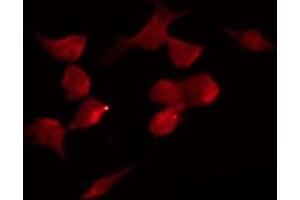 ABIN6269057 staining HepG2 by IF/ICC. (MAP3K7 antibody  (Internal Region))