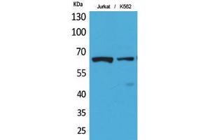 Western Blot (WB) analysis of Jurkat, K562 cells using Acetyl-NFkappaB-p65 (K218) Polyclonal Antibody. (NF-kB p65 antibody  (acLys218))