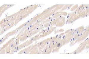 Detection of IL18 in Rabbit Cardiac Muscle Tissue using Polyclonal Antibody to Interleukin 18 (IL18) (IL-18 antibody  (AA 32-192))