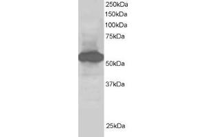 ABIN185071 staining (1µg/ml) of Human Kidney lysate (RIPA buffer, 30µg total protein per lane). (SIL1 antibody  (C-Term))
