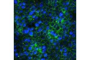 IF analysis of Claudin 3/CLDN3 using anti-Claudin 3/CLDN3 antibody (ABIN7602816).