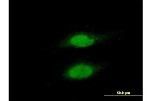 Immunofluorescence of purified MaxPab antibody to RAD23B on HeLa cell.