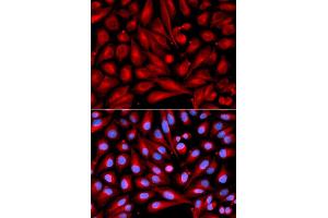 Immunofluorescence analysis of U2OS cells using MAP2K7 antibody (ABIN5971212).