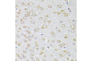 Immunohistochemistry of paraffin-embedded mouse brain using NTS antibody (ABIN5998396) at dilution of 1/100 (40x lens). (Neurotensin antibody)