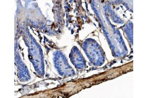 IHC analysis of Integrin Linked ILK using anti-Integrin Linked ILK antibody (ABIN7599411). (ILK antibody  (AA 1-452))