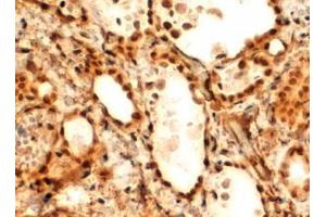 Antibody (2µg/ml) staining of paraffin embedded Human Thyroid Gland. (FOXE1 antibody  (C-Term))