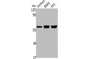 Western Blot analysis of Jurkat K562 NIH-3T3 cells using ENT1 Polyclonal Antibody (SLC29A1 antibody  (N-Term))