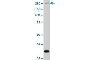 ARID1B monoclonal antibody (M02), clone 2F2 Western Blot analysis of ARID1B expression in Hela S3 NE . (ARID1B antibody  (AA 1364-1460))