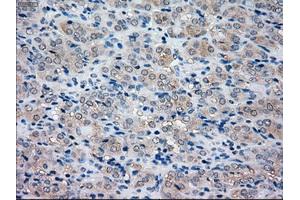 Immunohistochemical staining of paraffin-embedded pancreas tissue using anti-NRBP1mouse monoclonal antibody. (NRBP1 antibody)