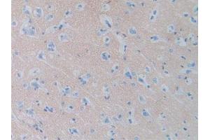 Figure. (SIRPA antibody  (AA 105-324))