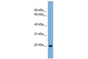 CD8B antibody used at 1 ug/ml to detect target protein. (CD8B antibody  (Middle Region))