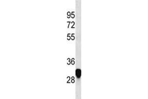 PLP antibody western blot analysis in HeLa lysate (PLP1 antibody  (AA 248-277))