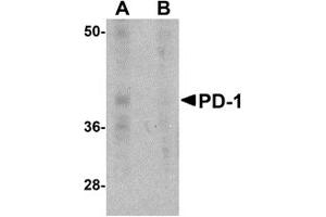 Western Blotting (WB) image for anti-Programmed Cell Death 1 (PDCD1) antibody (ABIN492541) (PD-1 antibody)
