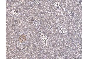 IHC analysis of Cathepsin L/MEP/Ctsl using anti-Cathepsin L/MEP/Ctsl antibody (ABIN7603032).