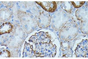 Immunohistochemistry of paraffin-embedded Rat kidney using PDE3A Polyclonal Antibody at dilution of 1:100 (40x lens). (PDE3A antibody)