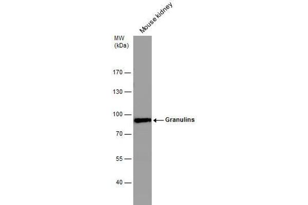 Granulin antibody  (Center)