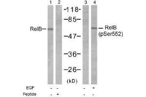 Image no. 1 for anti-V-Rel Reticuloendotheliosis Viral Oncogene Homolog B (RELB) (Ser552) antibody (ABIN197500) (RELB antibody  (Ser552))