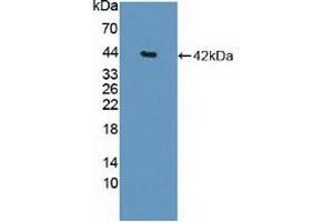 Detection of Recombinant HDAC9, Human using Polyclonal Antibody to Histone Deacetylase 9 (HDAC9) (HDAC9 antibody  (AA 23-343))