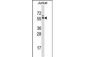 G3BP1 Antibody (C-term) (ABIN657707 and ABIN2846698) western blot analysis in Jurkat cell line lysates (35 μg/lane). (G3BP1 antibody  (C-Term))