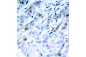 Immunohistochemistry (IHC) image for anti-Cyclin-Dependent Kinase 1 (CDK1) (pThr161) antibody (ABIN3020136) (CDK1 antibody  (pThr161))