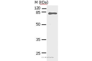 Western blot analysis of Human fetal lung tissue, using STAT5A Polyclonal Antibody at dilution of 1:450 (STAT5A antibody)