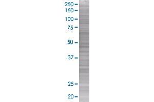 Western Blotting (WB) image for PLTP 293T Cell Transient Overexpression Lysate(Denatured) (ABIN1332998)