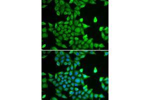 Immunofluorescence analysis of MCF-7 cells using PSMA6 antibody. (PSMA6 antibody)