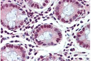 Human Colon (formalin-fixed, paraffin-embedded) stained with FUBP1 antibody ABIN462199 followed by biotinylated goat anti-rabbit IgG secondary antibody ABIN481713, alkaline phosphatase-streptavidin and chromogen. (FUBP1 antibody  (AA 540-589))