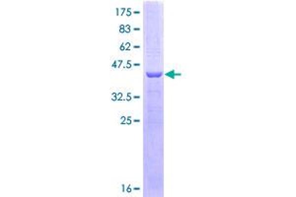CES2 Protein (AA 514-621) (GST tag)