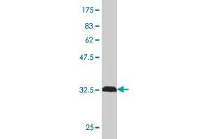 Western Blot detection against Immunogen (32. (MARCKS antibody  (AA 2-65))