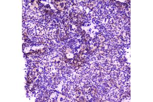 Immunohistochemistry (IHC) image for anti-Phospholipase C gamma 2 (PLCG2) (AA 1201-1258) antibody (ABIN5692854)