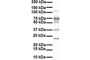 WB Suggested Anti-SLC27A3 antibody Titration: 1 ug/mL Sample Type: Human MCF7 (SLC27A3 antibody  (Middle Region))