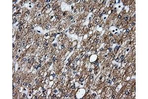 Immunohistochemical staining of paraffin-embedded liver tissue using anti-GBE1mouse monoclonal antibody. (GBE1 antibody)