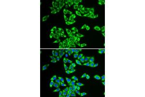 Immunofluorescence analysis of HeLa cells using DDX3X antibody. (DDX3X antibody  (AA 1-220))