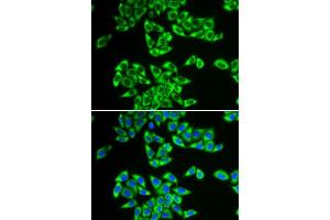 Immunofluorescence analysis of HeLa cells using DDX3X antibody. (DDX3X antibody  (AA 1-220))