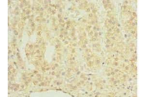Immunohistochemistry of paraffin-embedded human adrenal gland tissue using ABIN7147636 at dilution of 1:100 (CHAD antibody  (AA 23-359))