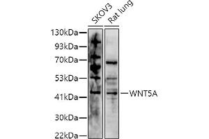 Western blot analysis of extracts of various cell lines, using (ABIN6134458, ABIN6150248, ABIN6150249 and ABIN6216485) at 1:1000 dilution. (WNT5A antibody  (AA 250-350))