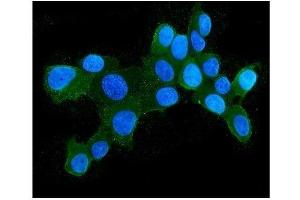 IF analysis of HSPH1 using anti-HSPH1 antibody (ABIN7602237).