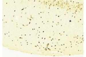ABIN6276281 at 1/100 staining Mouse brain tissue by IHC-P. (STAT1 antibody  (C-Term))