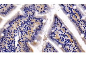 Immunohistochemistry (IHC) image for anti-Trefoil Factor 2 (TFF2) (AA 25-127) antibody (ABIN7432517)