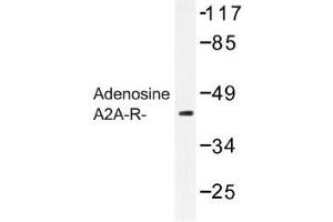 Image no. 1 for anti-Adenosine A2a Receptor (ADORA2A) antibody (ABIN317694) (Adenosine A2a Receptor antibody)